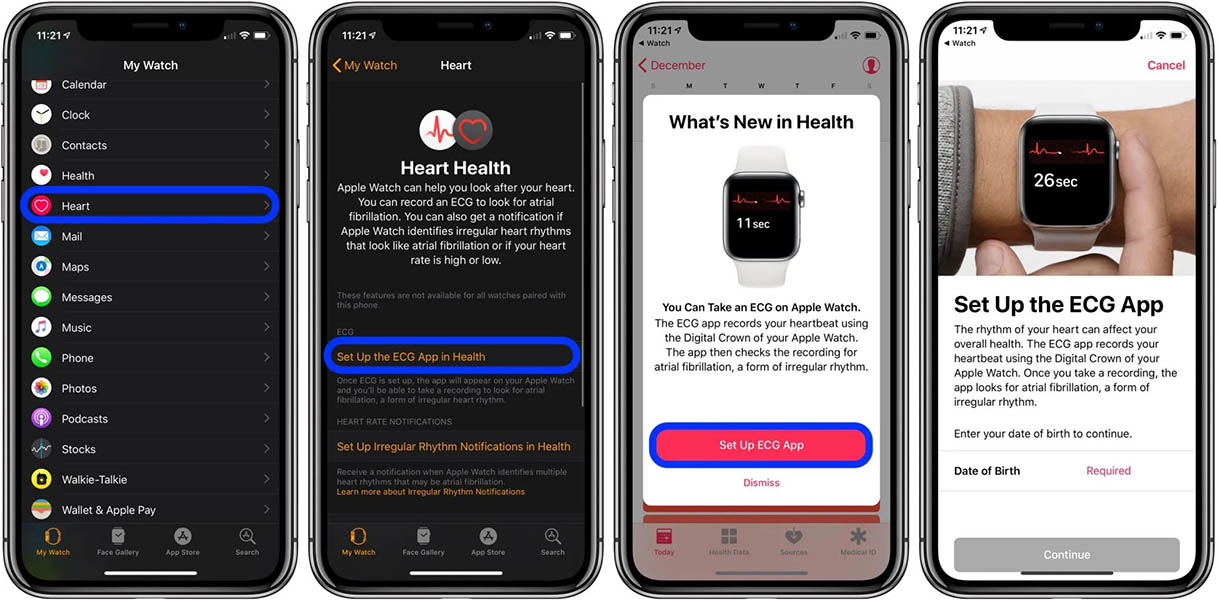 How To Take ECG or EKG on Apple Watch With ECG App