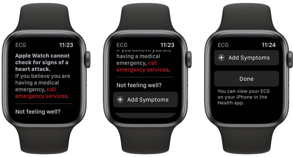 Record an electrocardiogram with the ECG app on Apple Watch