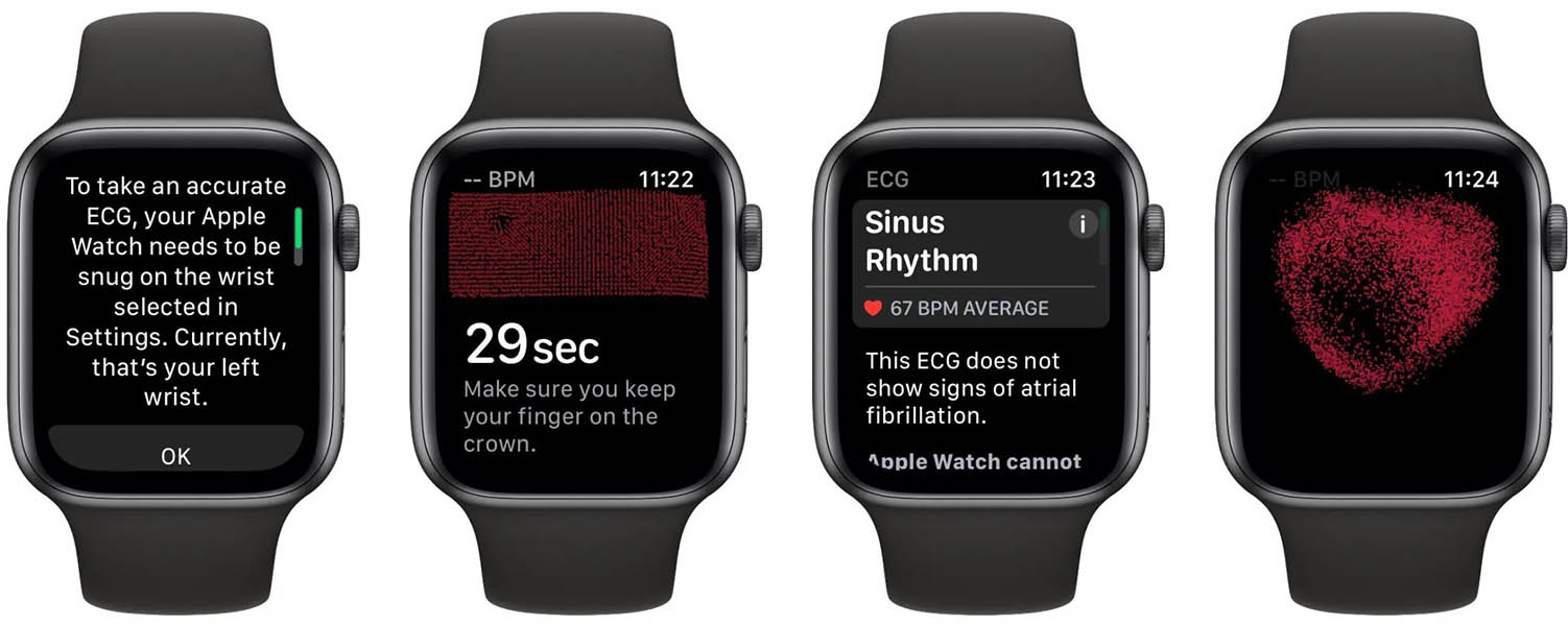 Take an ECG with the ECG app on Apple Watch